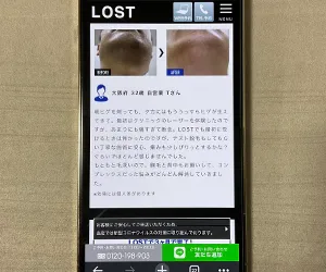 LOST