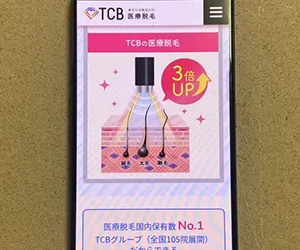 TCB東京中央美容外科