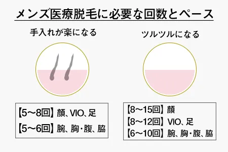 メンズ医療脱毛に必要な回数とペース・効果の関係｜ヒゲなら8~15回程度でツルツルになる