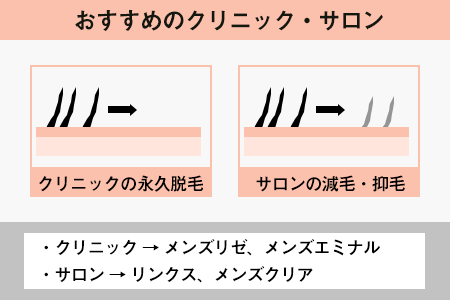 全身脱毛の範囲を確認する｜ヒゲ・VIOが含まれているかをチェック