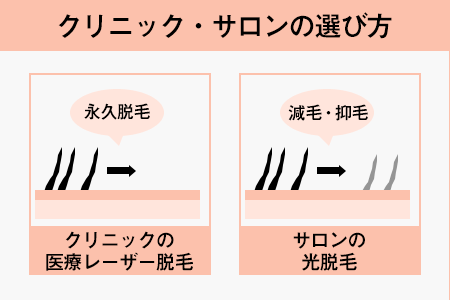 クリニックかサロンのどちらを選ぶか決める｜クリニックなら低価格・短期間で全身脱毛が完了